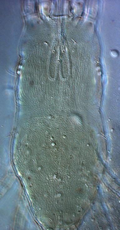 Pineapple false spider mite